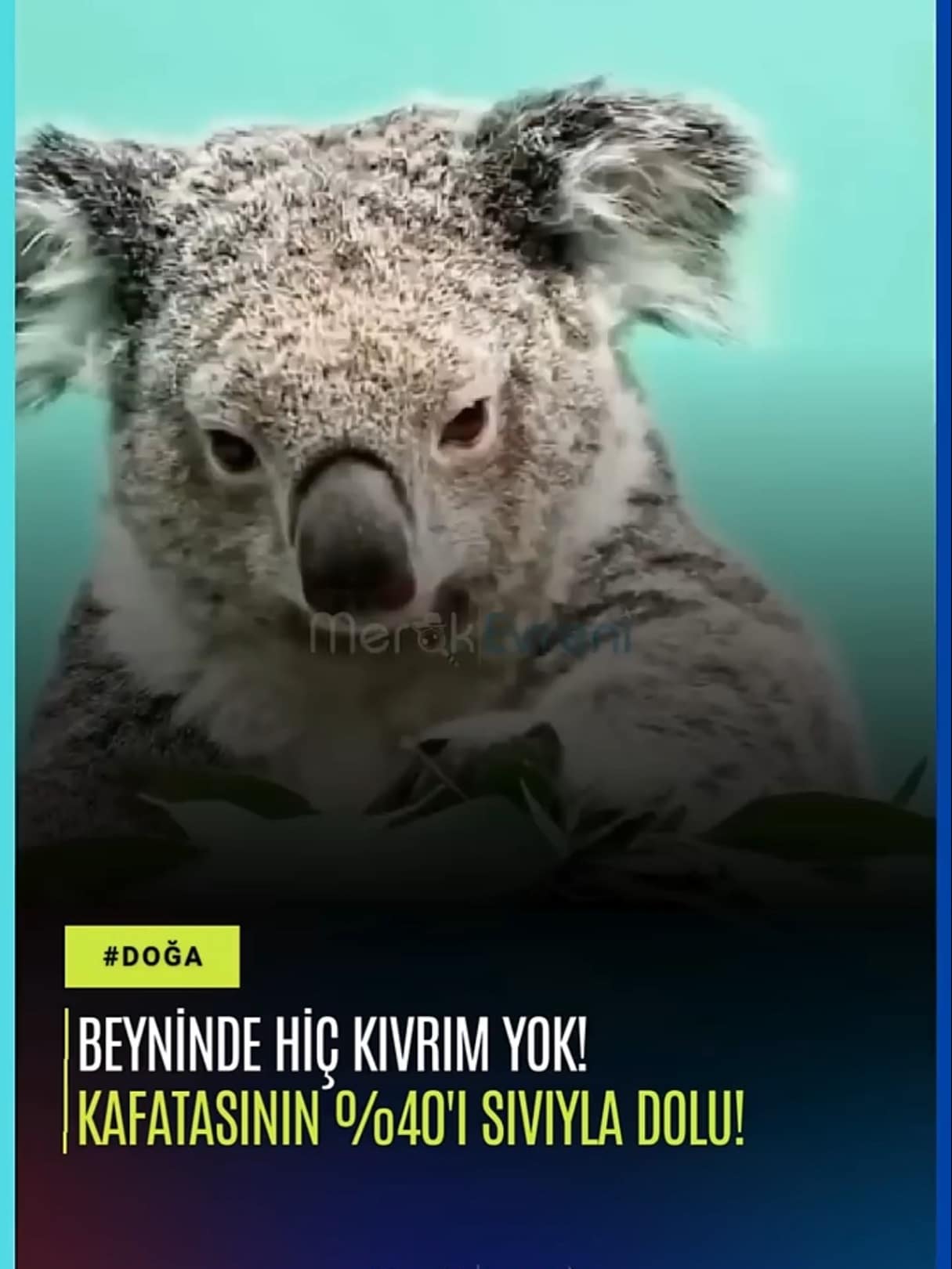 Beyninde hiç kıvrım yok! Kafatasının %40'ı Sıvıyla Dolu!