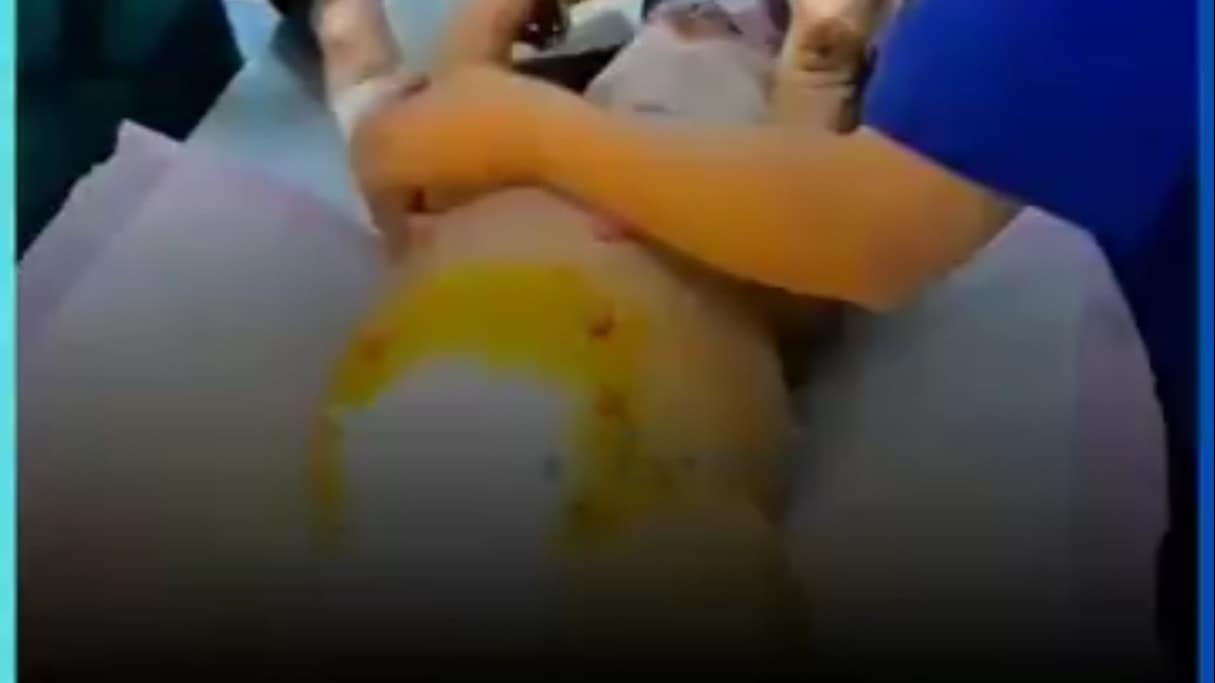 Karnı Patlamak Üzereydi... Ultrasonda Gördüklerine İnanamadılar! (18 Yavru)
